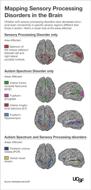 SPD and Autism differences